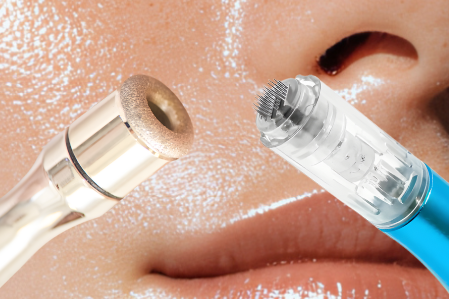 Micro-needling vs Microdermabrasion: My Two Favorite Treatments For Fine Lines And Acne Scars