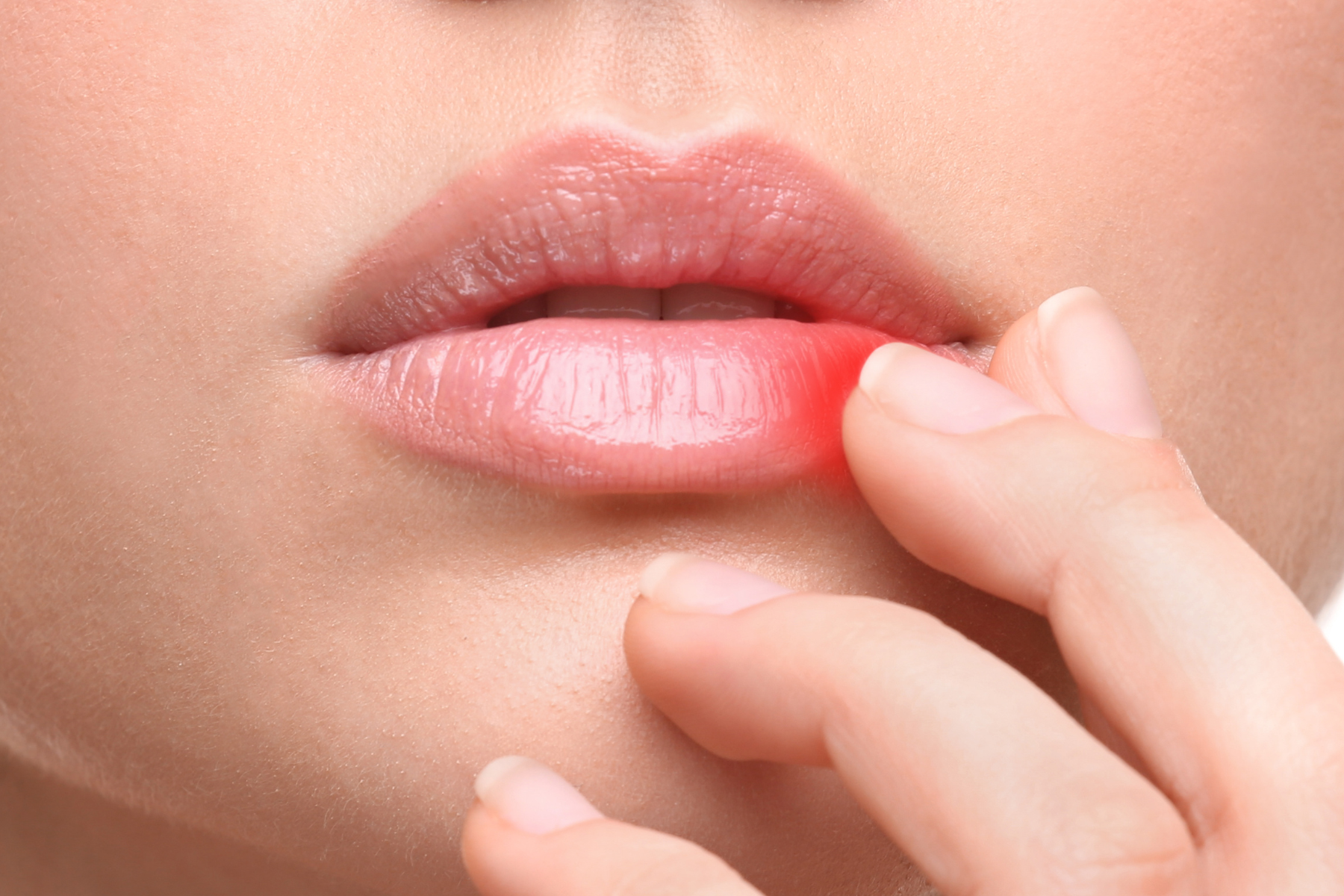 How To Get Rid Of Cold Sores: Outbreak Ghosted!